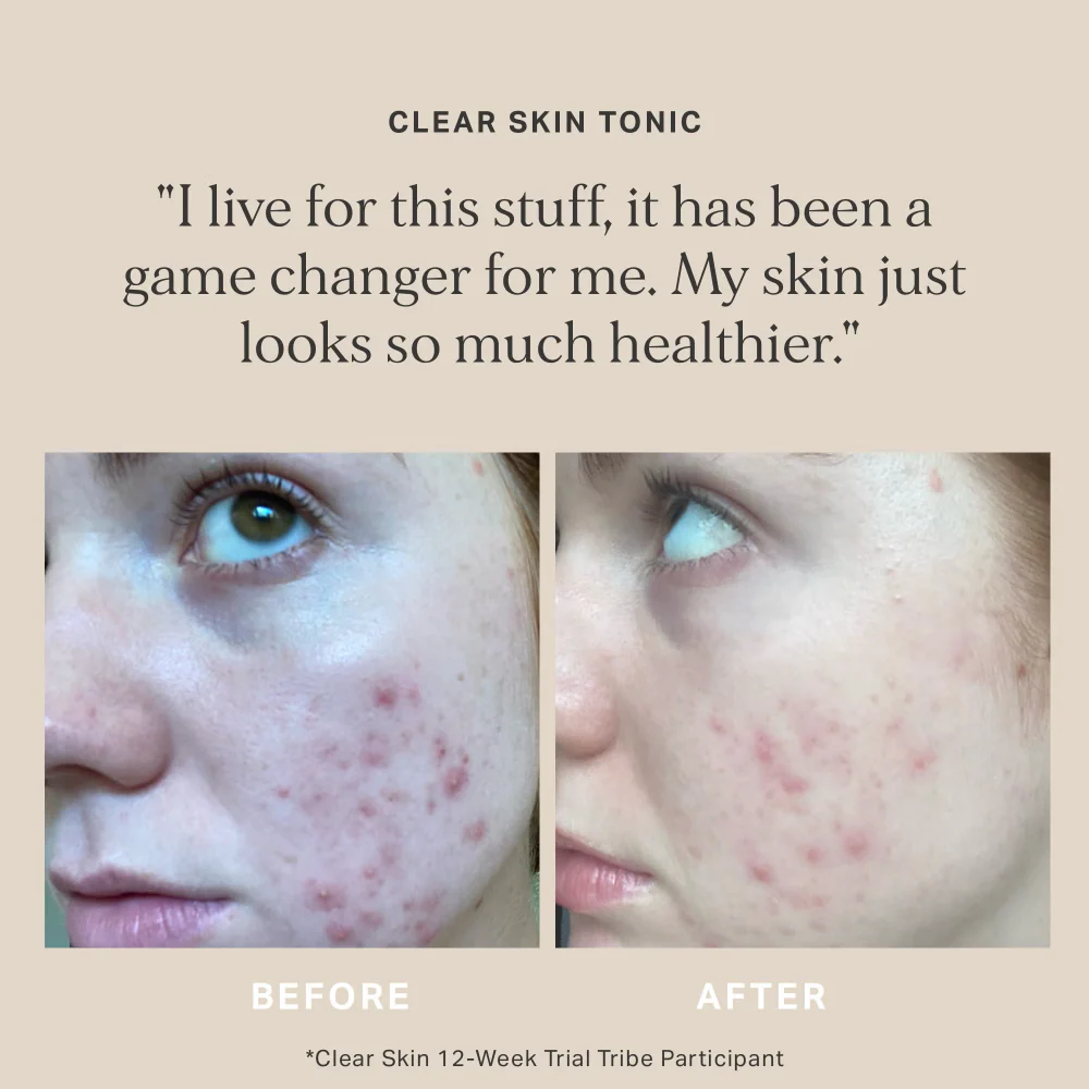 ALPHA-H Clear Skin Tonic 100ml - Image 3