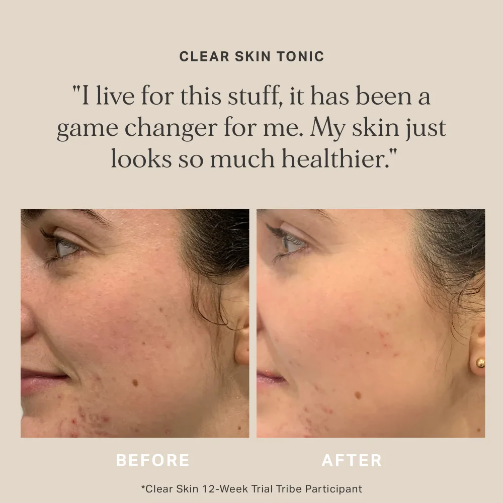 ALPHA-H Clear Skin Tonic 100ml - Image 4