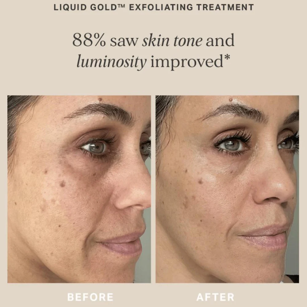 ALPHA-H Liquid Gold + Glycolic Acid Exfoliating Treatment 100ml - Image 8
