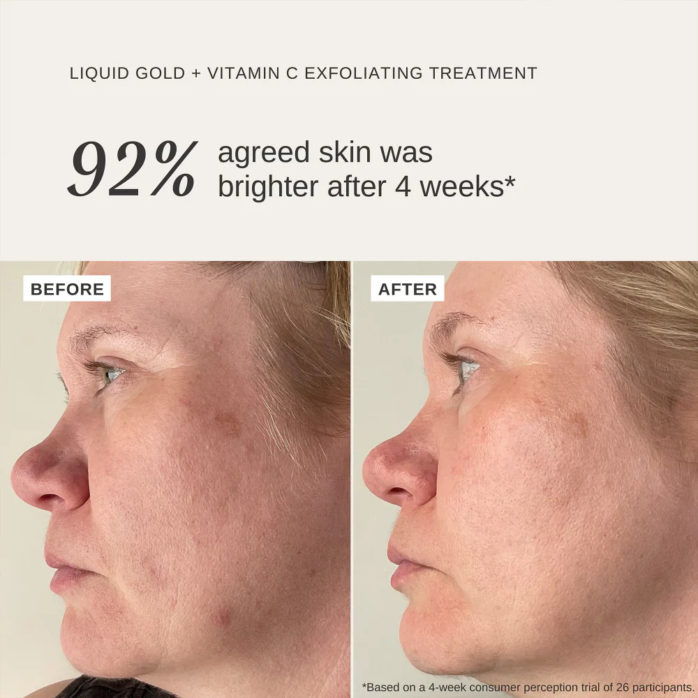 ALPHA-H Liquid Gold + Vitamin C Exfoliating Treatment 100ml - Image 2