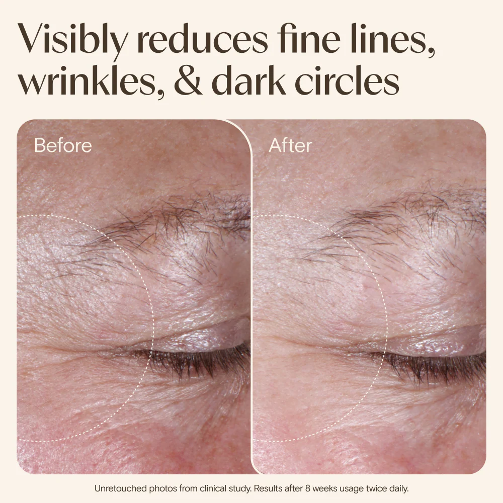 Aveeno Age Renewal Eye Gel Cream Retinol Alternative 15ml - Image 5