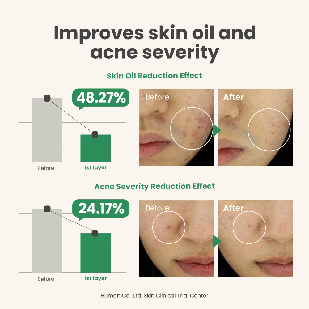 Axis-Y 6+1+1 Spot the Difference Blemish Treatment 15ml - Image 6