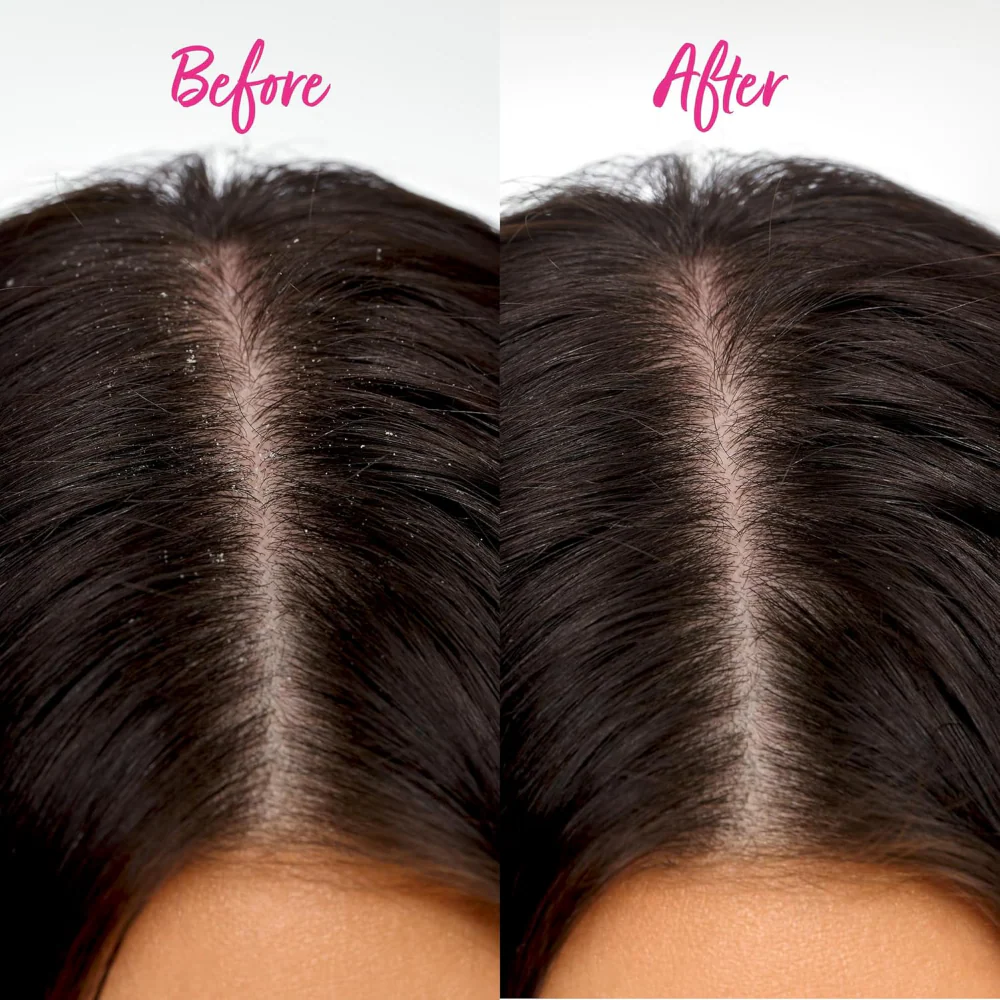 Brushworks Scalp Detox Comb - Image 6