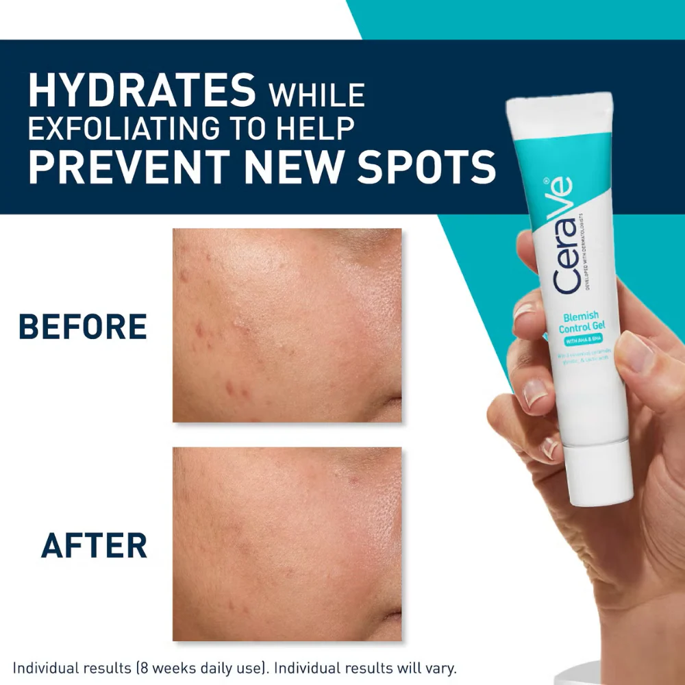 CeraVe Blemish Control Gel 40ml - Image 5