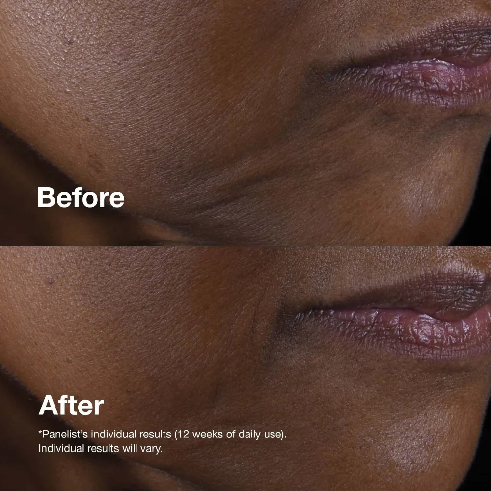 Clinique Smart Clinical Repair Lifting Face & Neck Cream 50ml - Image 3