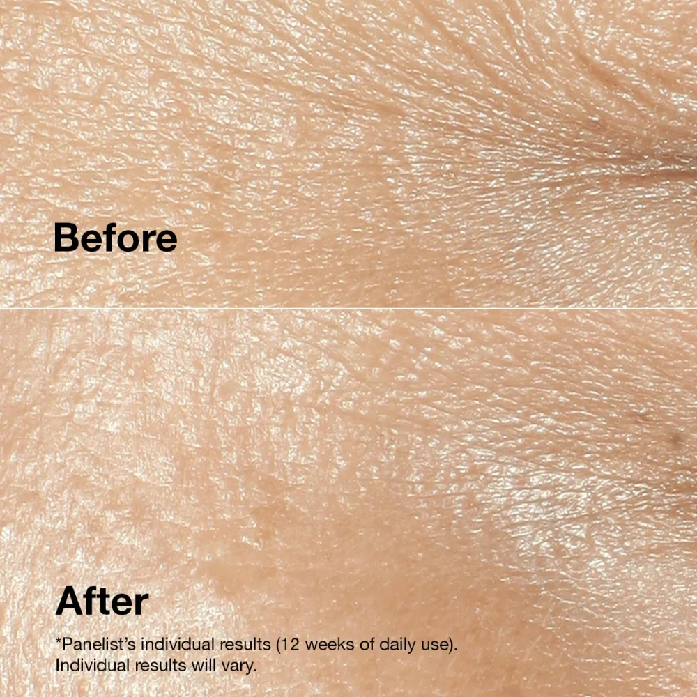Clinique Smart Clinical Repair Wrinkle Correcting Cream 50ml - Image 4