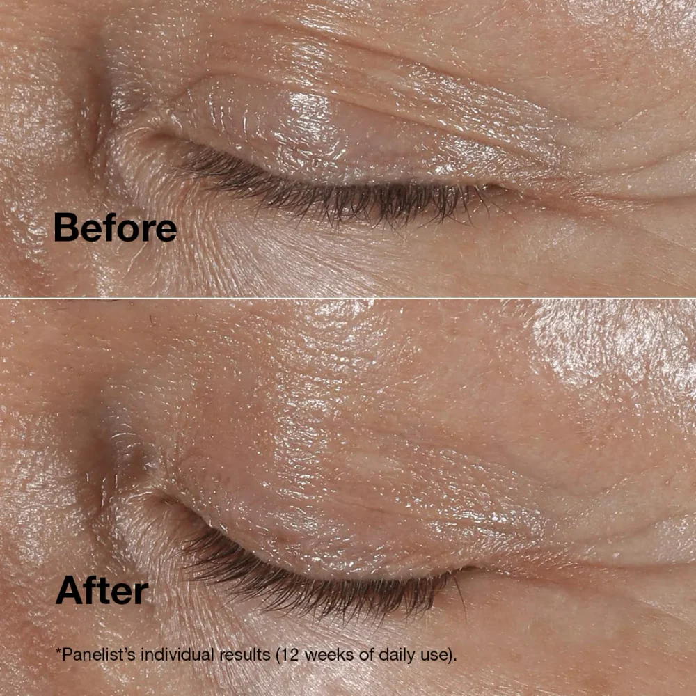 Clinique Smart Clinical Repair Wrinkle Correcting Eye Cream 15ml - Image 5