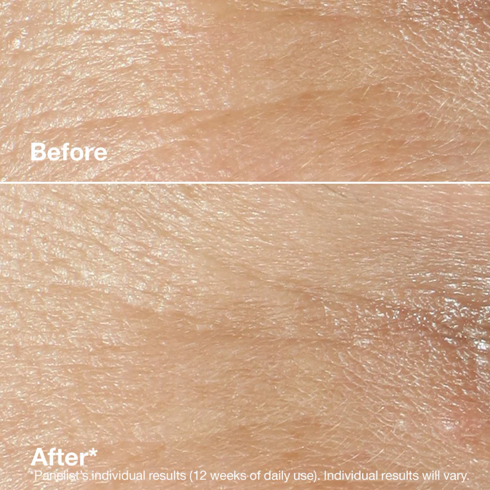 Clinique Smart Clinical Repair Wrinkle Correcting Rich Cream 50ml - Image 2