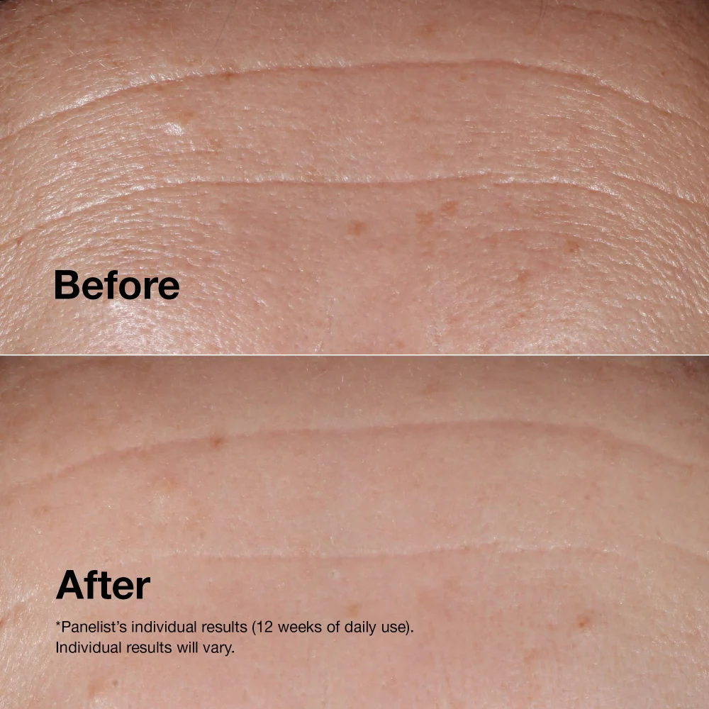 Clinique Smart Clinical Repair Wrinkle Correcting Serum 75ml - Image 3