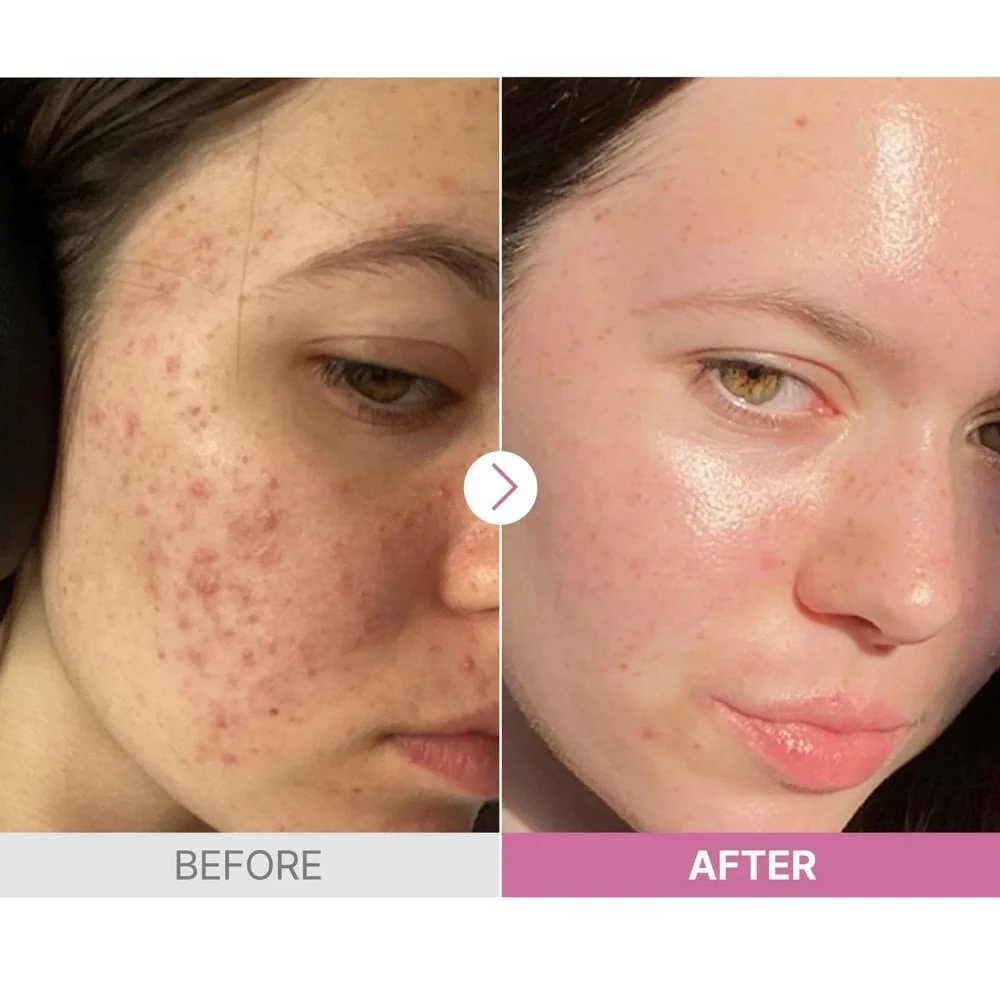 CosRx The Niacinamide 15 Serum 20g - Image 6