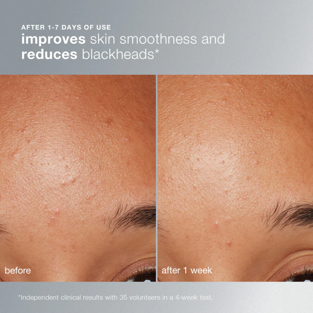 Dermalogica Daily Microfoliant Brightening Powder Exfoliant 13g - Image 4