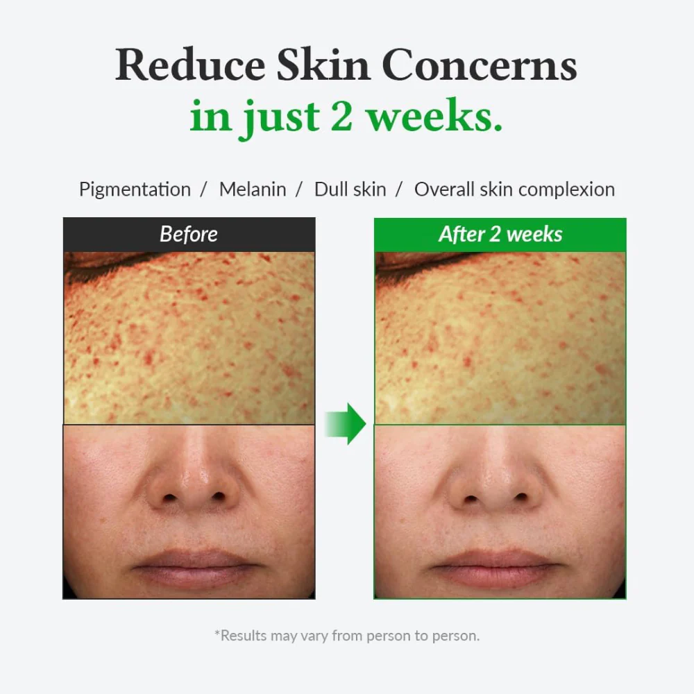 Dr. Althea Gentle Vitamin C Serum 30ml - Image 4