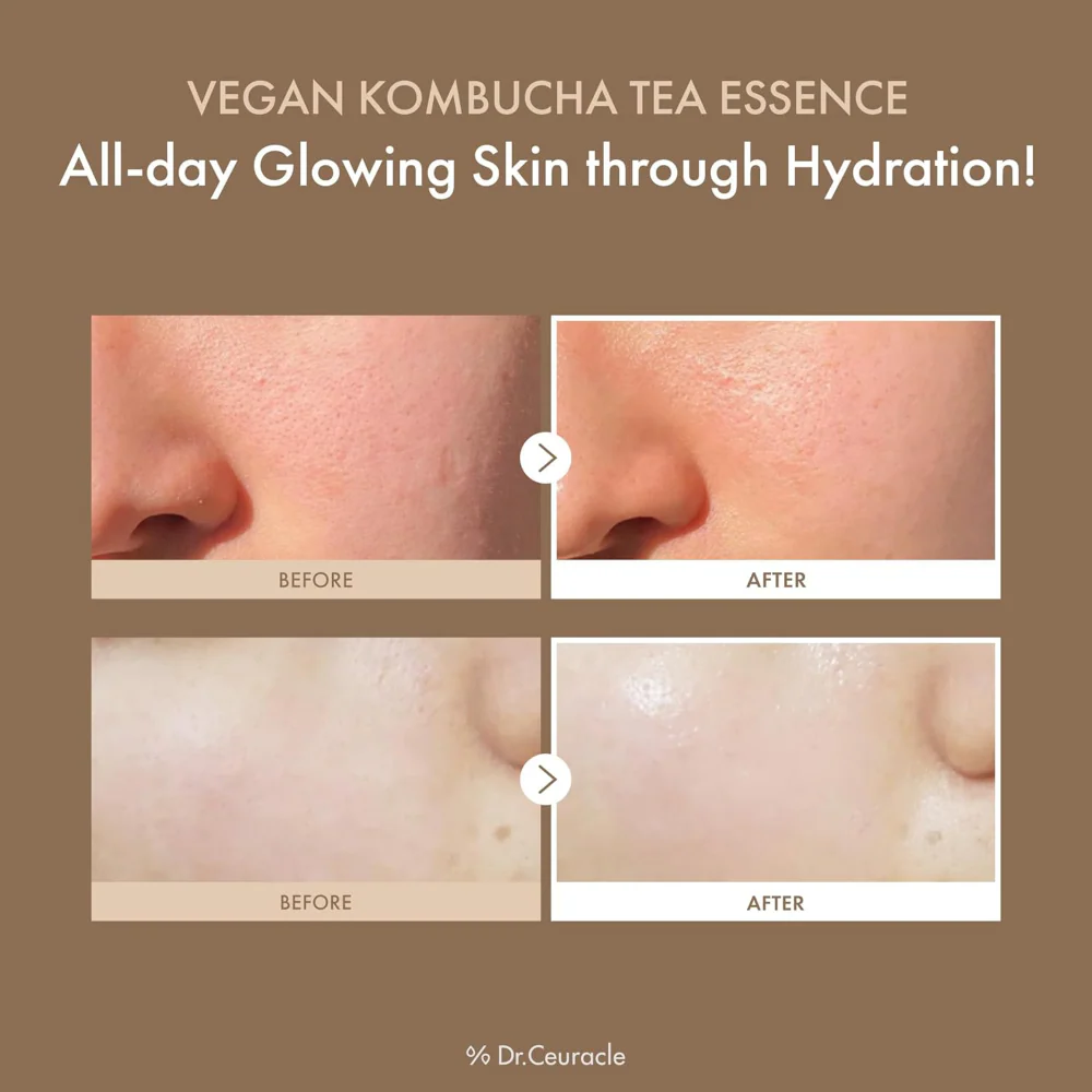 Dr. Ceuracle Vegan Kombucha Tea Essence 150ml - Image 3