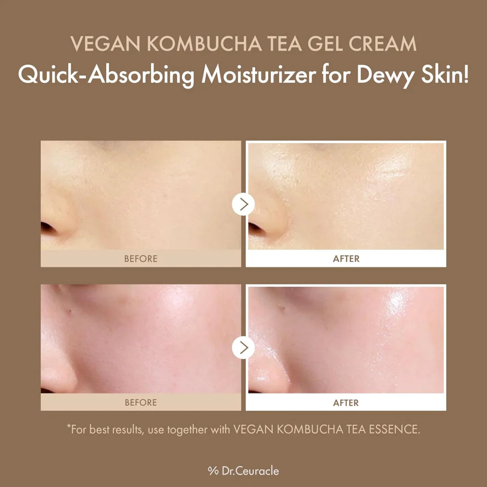 Dr. Ceuracle Vegan Kombucha Tea Gel Cream 75g - Image 3