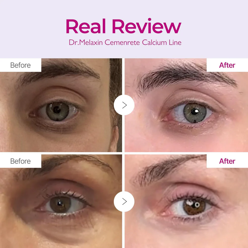 Dr. Melaxin Cemenrete Calcium Intense Cream 50ml - Image 3