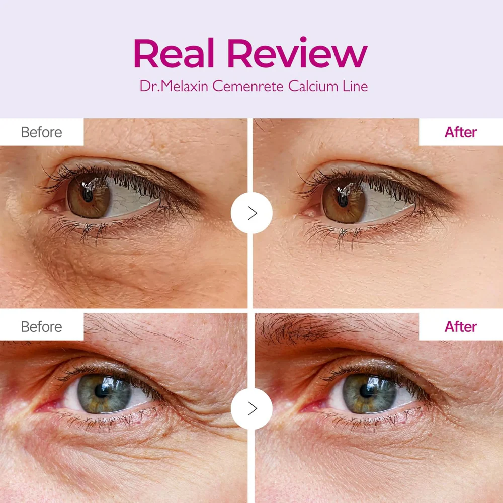 Dr. Melaxin Cemenrete Calcium Volume Eye Patches x60 - Image 4