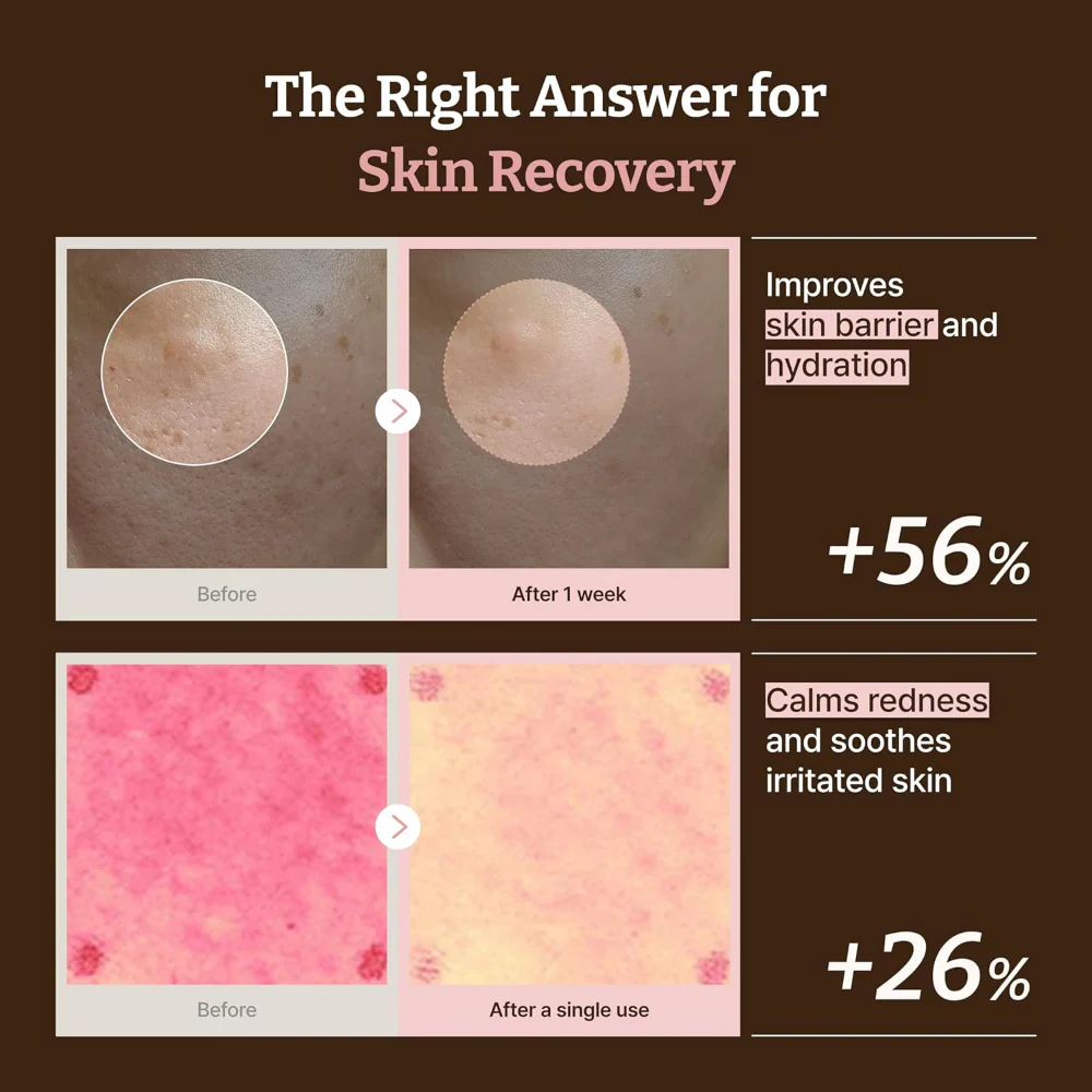 Dr. Reju-All Advanced PDRN Rejuvenating Cream Max 60ml - Image 5