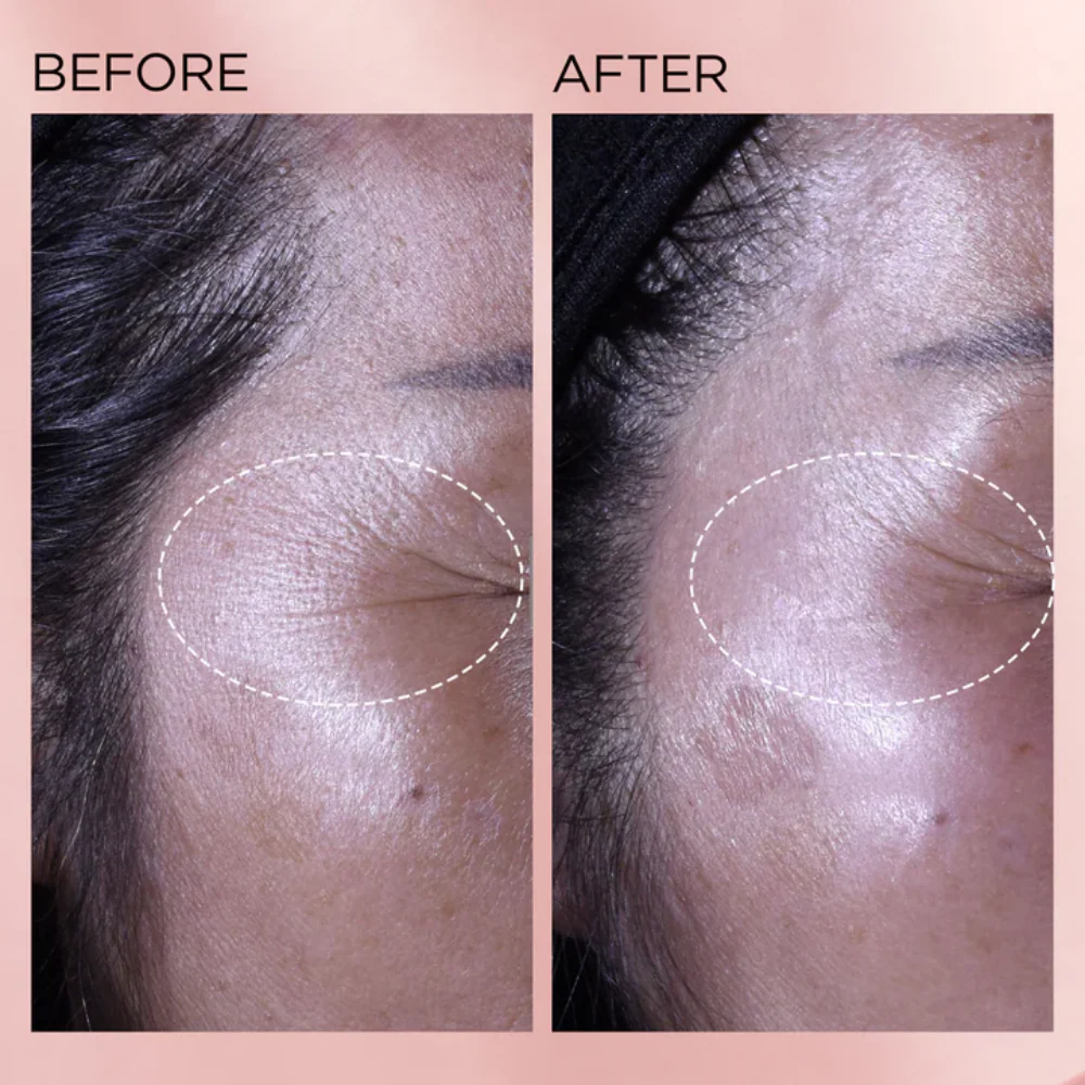 Elizabeth Arden Retinol + HPR Rapid Skin Renewing Ceramide Serum 90 Capsules - Image 5