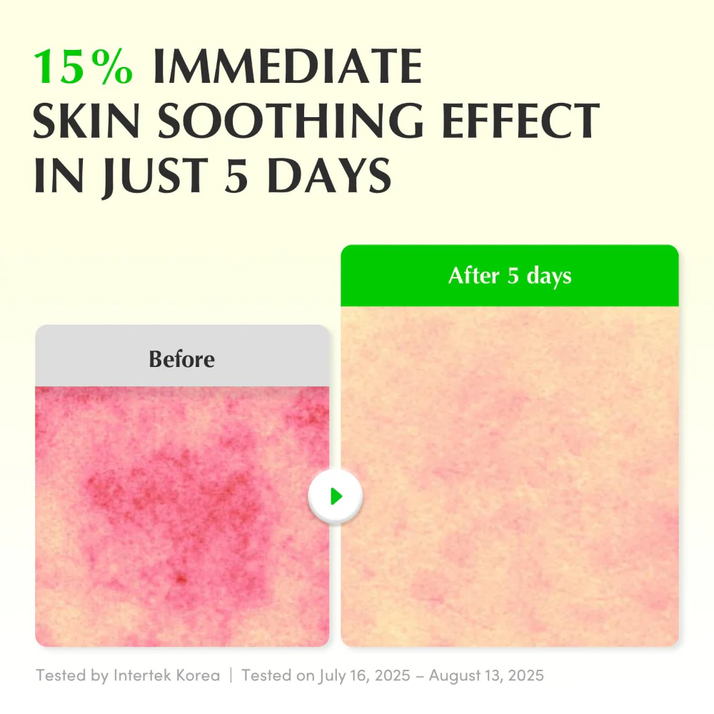 Eqqualberry Green Aid Aloe PDRN Calming Serum 30ml - Image 3