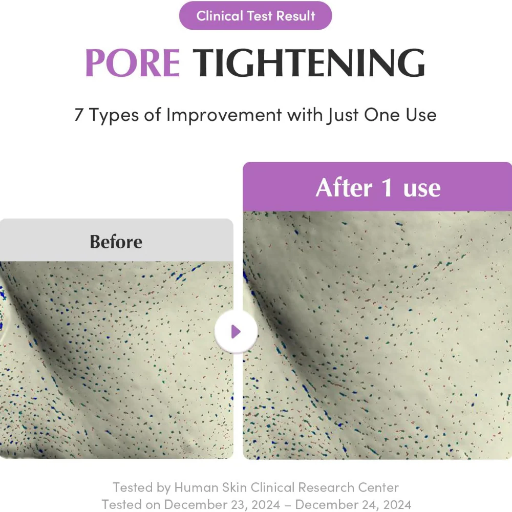 Eqqualberry Pore Fit Purple Rice Pore Purifying Pack Cleanser 130ml - Image 4