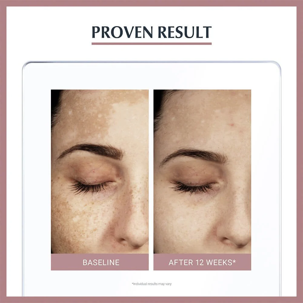 Eucerin Anti-Pigment Dual Face Serum 30ml - Image 7