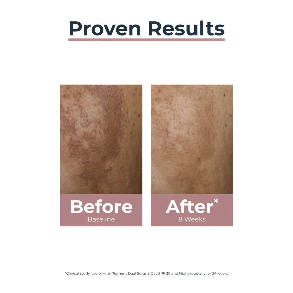 Eucerin Anti-Pigment Skin Perfecting Serum 30ml - Image 7