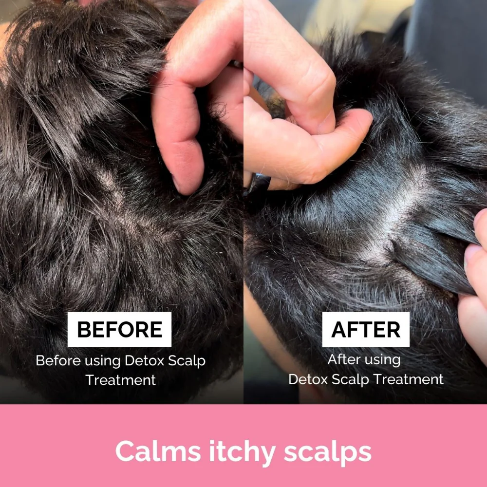 FUL Detox Scalp Treatment 150ml - Image 5