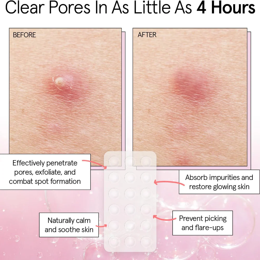 Grace & Stella Hydrocolloid Pimple Patches Clear x72 - Image 3