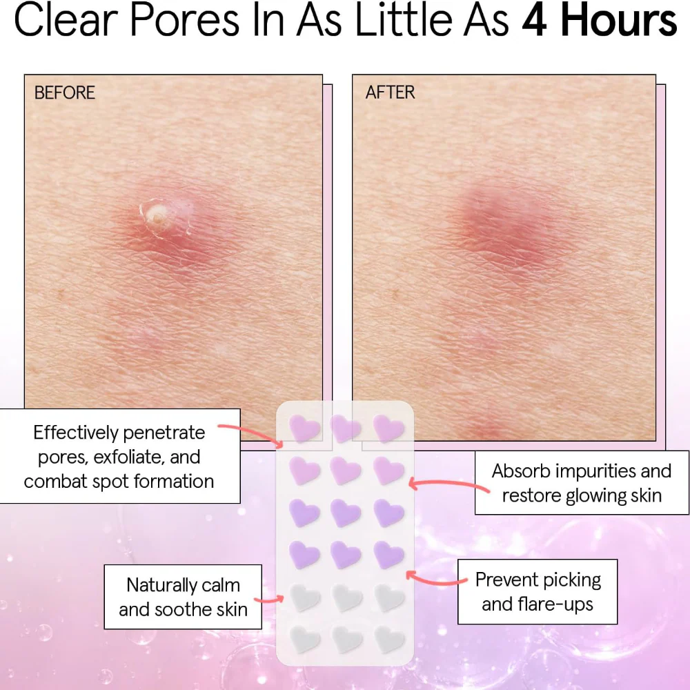Grace & Stella Hydrocolloid Pimple Patches Heart x36 - Image 3