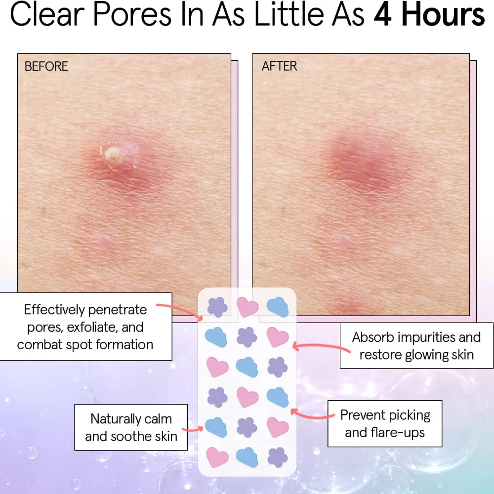 Grace & Stella Hydrocolloid Pimple Patches Multishape x36 - Image 3