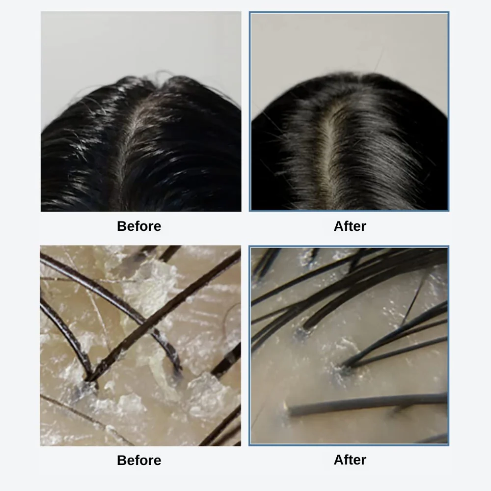 GROWUS Sea Salt Therapy Scalp Scaler 250g - Image 5