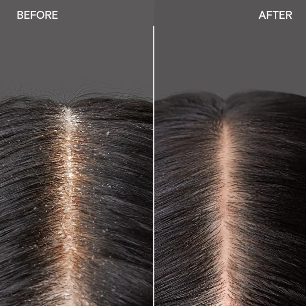Joico Scalp Vitality Refreshing Shampoo 300ml - Image 3