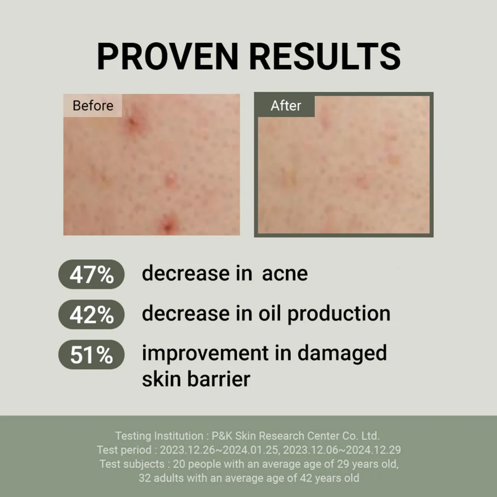 Jumiso Snail Mucin 88 + Peptide Facial Cream 100ml - Image 5