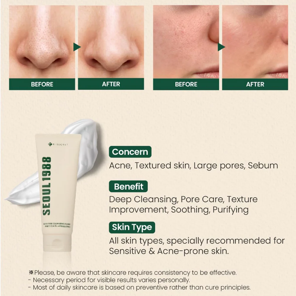 K-Secret Seoul 1988 Cleansing Foam: Pine Cica 1% + Probiotics 150ml - Image 4