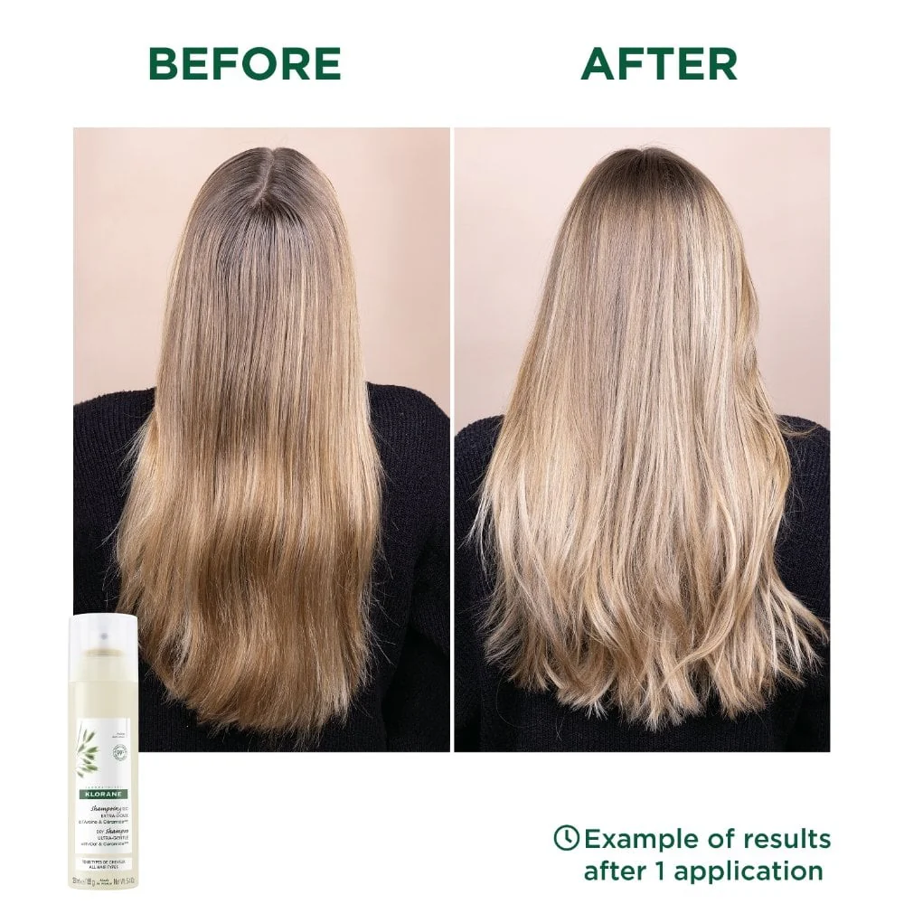 Klorane Extra-Gentle Dry Shampoo 250ml - Image 2