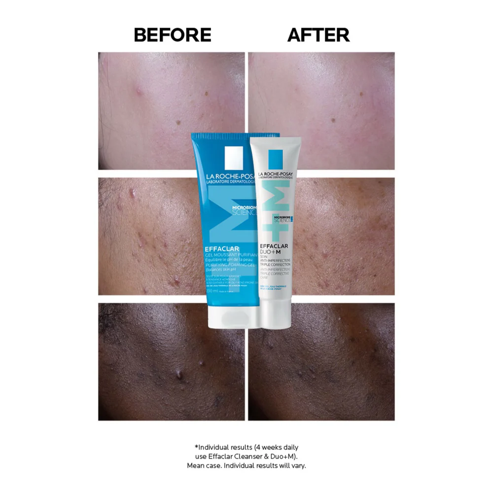 La Roche-Posay Effaclar Duo+M Triple Corrective Care Treatment 40ml - Image 2