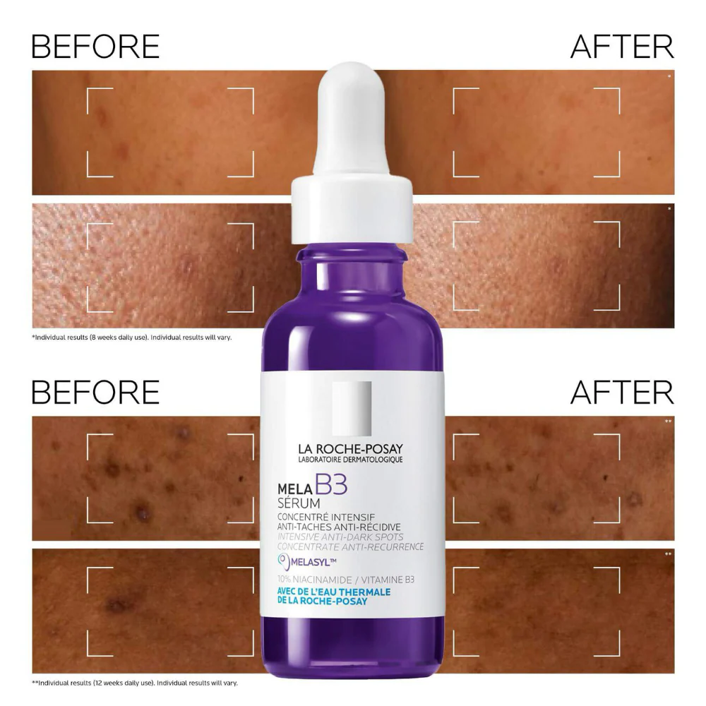 La Roche-Posay Mela B3 Intense Dark Spot Corrector Serum 30ml - Image 3