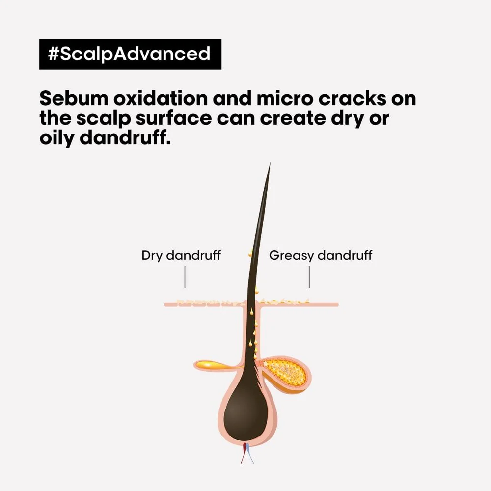 L'Oreal Professionnel Serie Expert Scalp Advanced Anti-Dandruff Dermo-Clarifier Shampoo 300ml - Image 3
