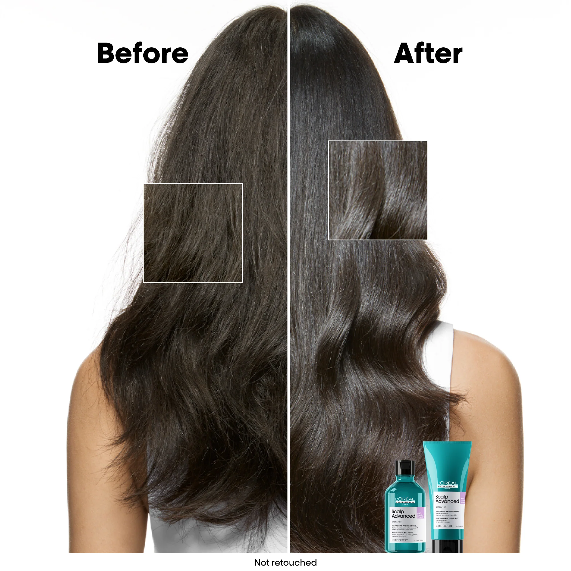L'Oreal Professionnel Serie Expert Scalp Advanced Anti-Discomfort Dermo-Regulator Shampoo 300ml - Image 3