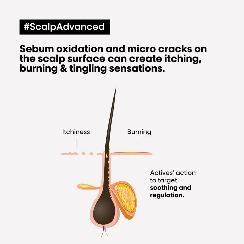 L'Oreal Professionnel Serie Expert Scalp Advanced Anti-Discomfort Dermo-Regulator Shampoo 300ml & Intense Soother Hair Treatment 200ml Twin - Image 5