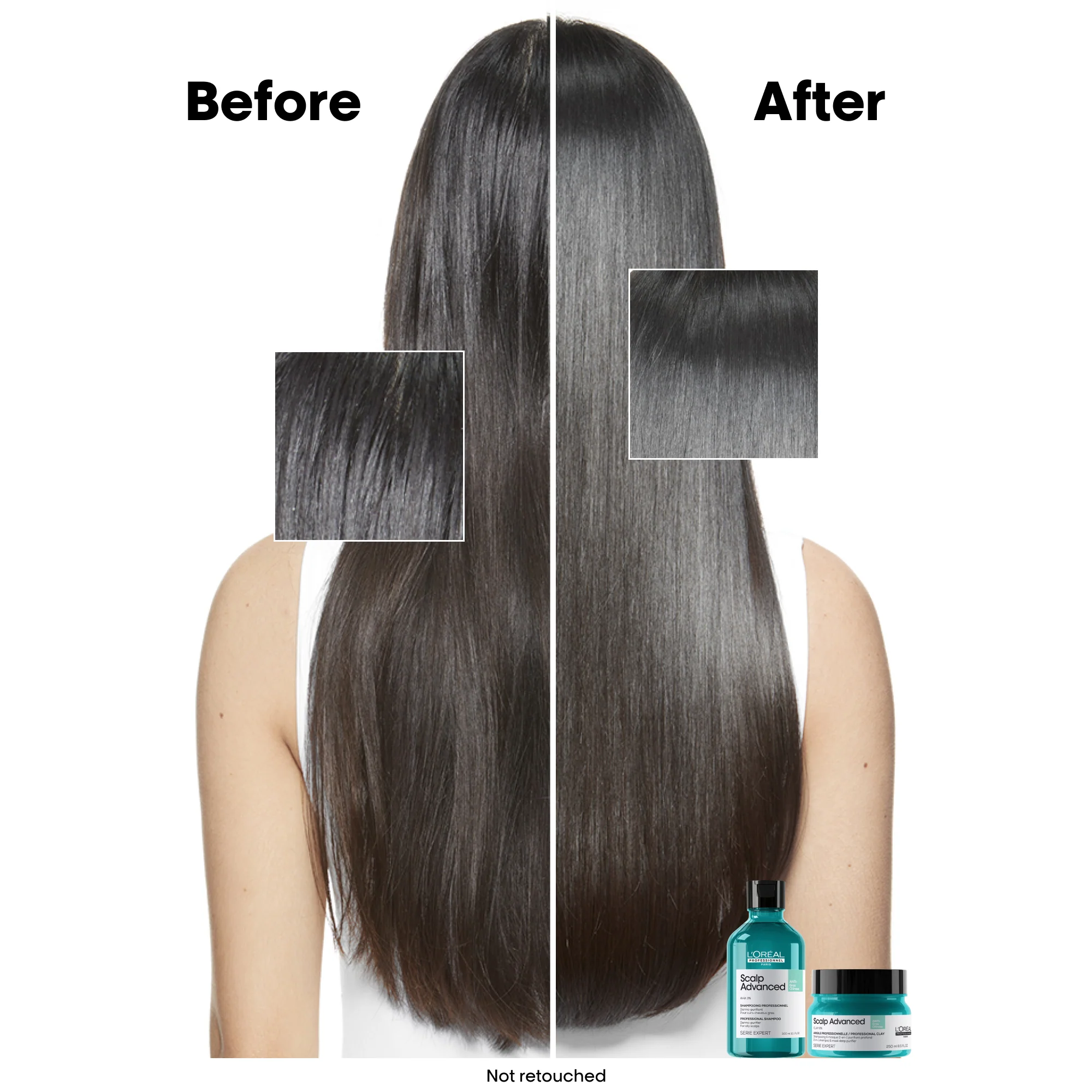L'Oreal Professionnel Serie Expert Scalp Advanced Anti-Oiliness Dermo-Purifier Shampoo 300ml - Image 3