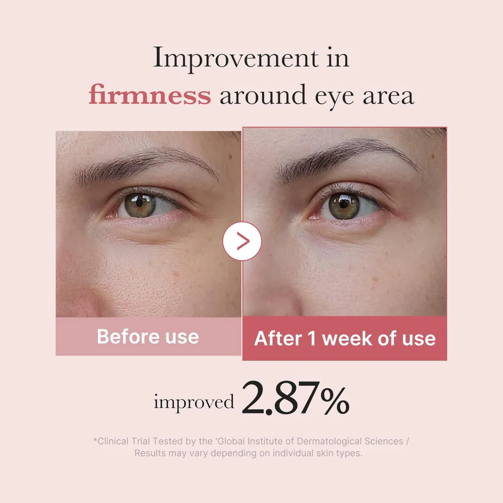 Medicube PDRN Pink Peptide Eye Cream 30ml - Image 4