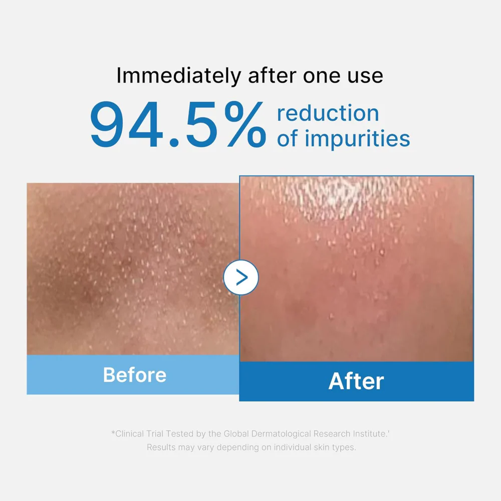 Medicube Zero Pore Blackhead Cleansing Oil 205ml - Image 3