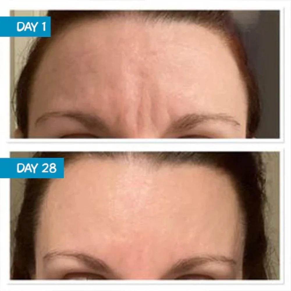 MooGoo Bakuchiol 1% Natural Retinol Substitute Active Serum 25ml - Image 2