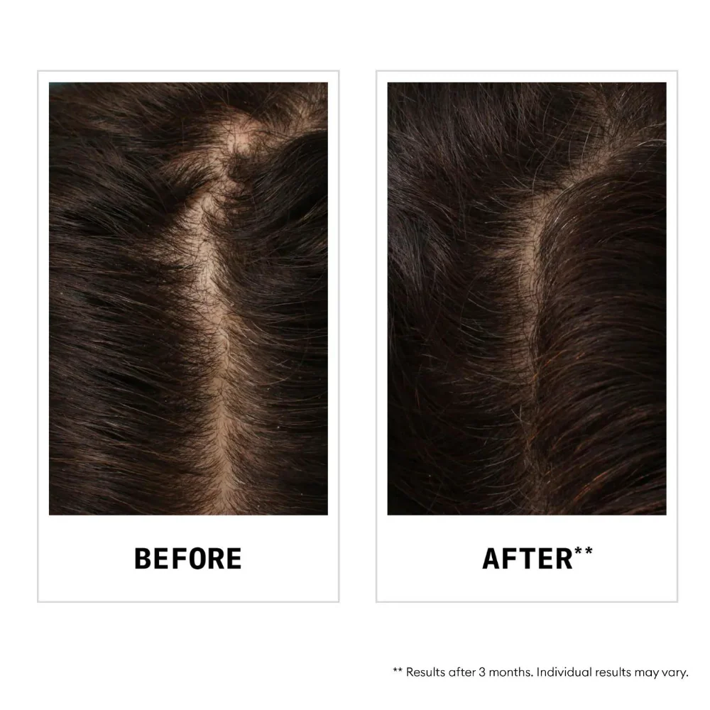 Nioxin Anti-Hair Loss Shampoo 240ml - Image 4