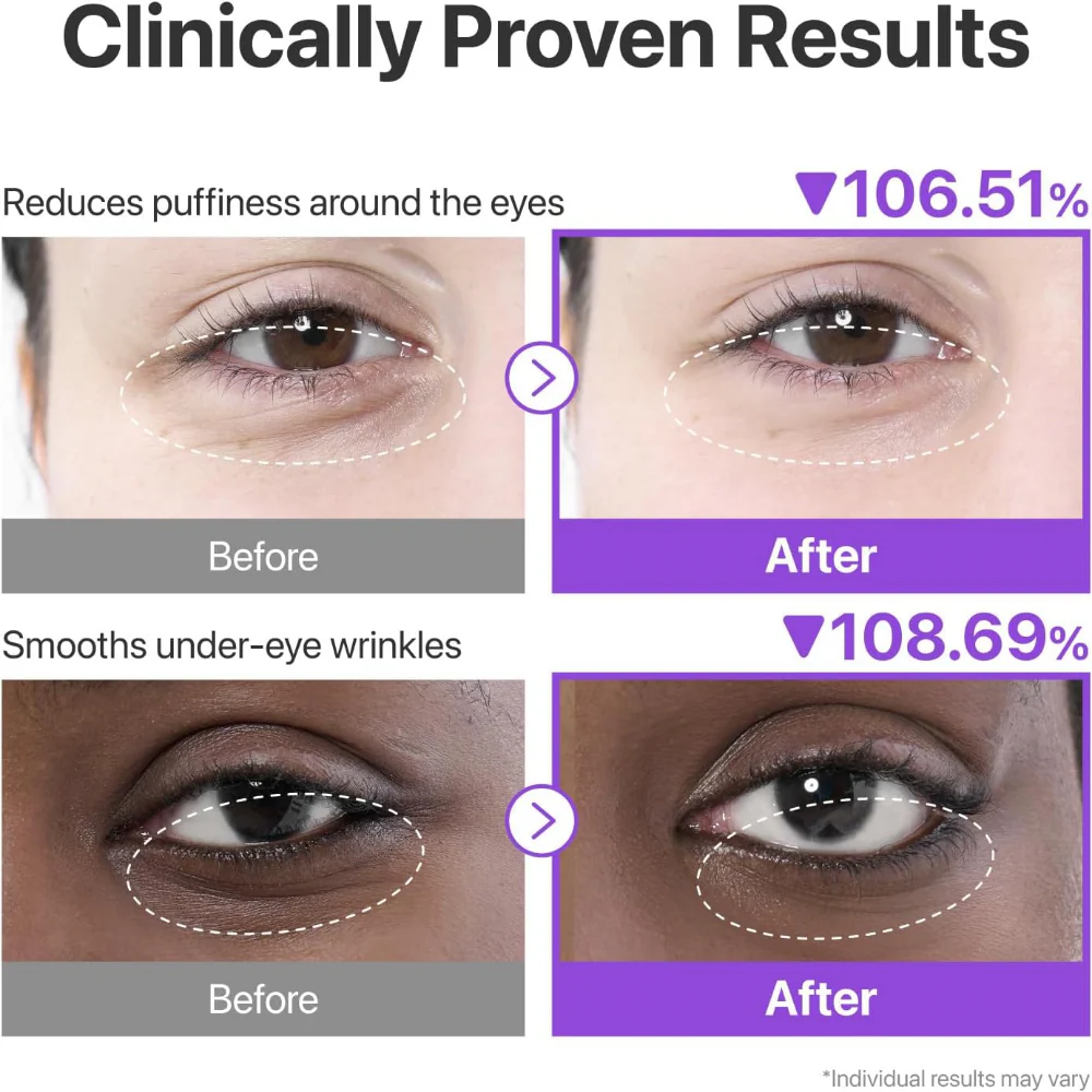 Numbuzin No. 9 NAD+ Collagen Under Eye Patches 5 Pairs - Image 3