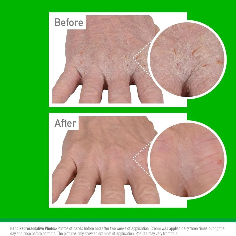 O'Keeffe's Clinical Hand Eczema Relief Hand Cream 57g - Image 4