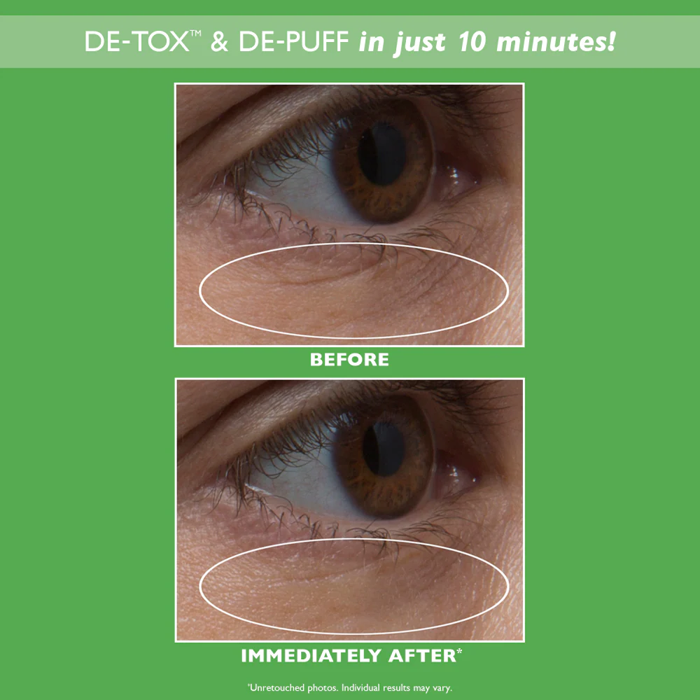 Peter Thomas Roth Cucumber De-Tox Hydra-Gel Eye Patches 15 Pairs - Image 5