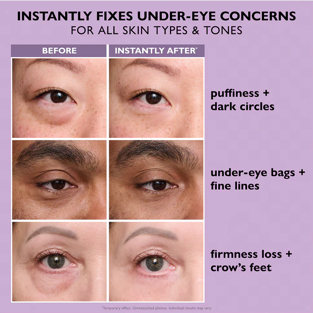 Peter Thomas Roth Instant FIRMx Eye Temporary Eye Tightener 20ml - Image 6