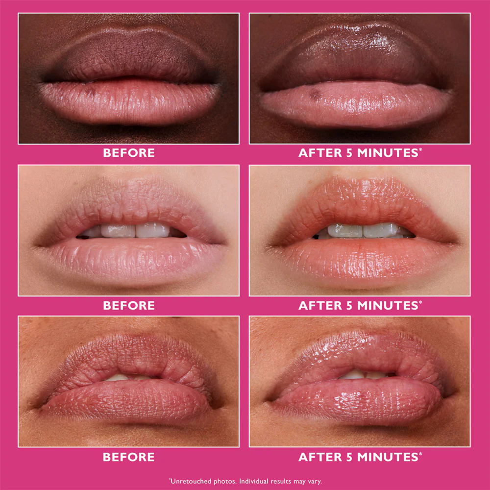 Peter Thomas Roth Instant FIRMx Lip Filler 10ml - Image 3